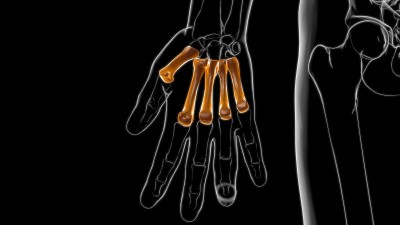 人类骨骼手卡拉pls骨解剖医学概念3D