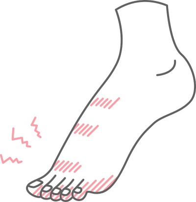 脚上冻疮的插图