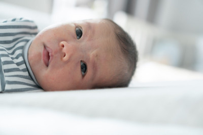 亚洲新生男婴躺在床上，脸上有常见的皮疹。