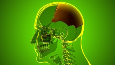 医学概念的人类骨骼、颅骨顶骨解剖