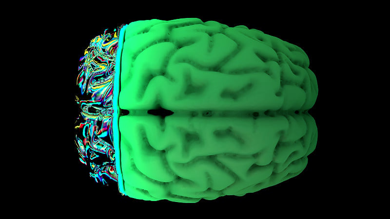 大脑的核磁共振扫描显示绿色