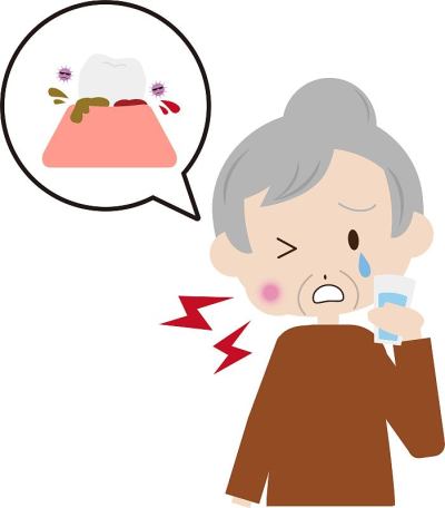 图解老年妇女含漱严重牙周病