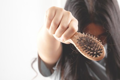 女性对洗发水过敏会导致脱发和头皮屑。