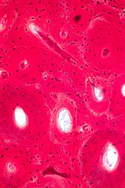 教育观念:解剖学和生理学的紧实骨，或实验室显微镜下的皮质骨。