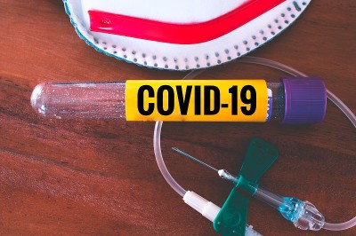 用口罩、插管和血液管进行冠状病毒感染的血液检测，并铭刻covid-19