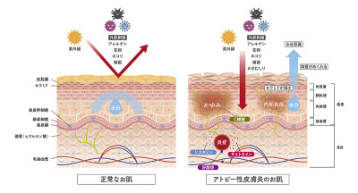 Cross section of the skin 3 front