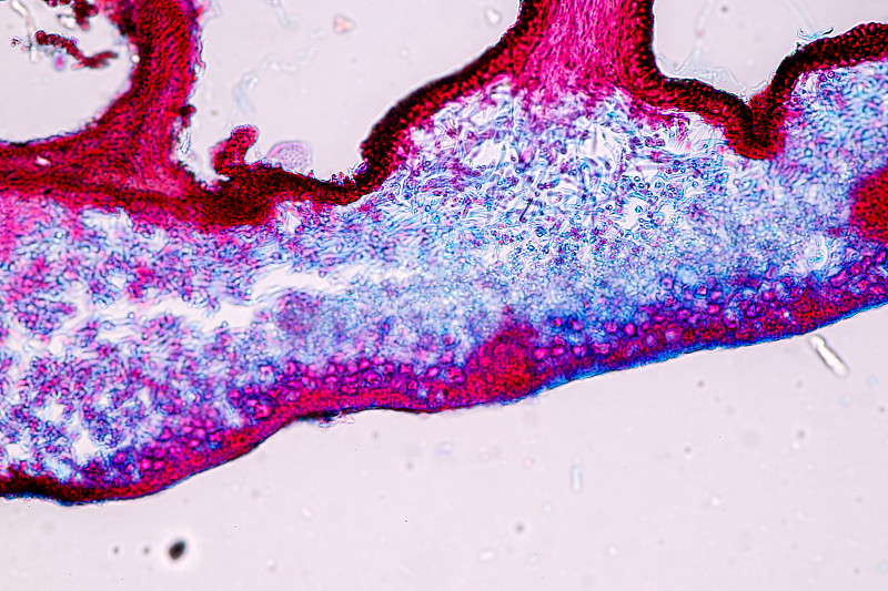 苔藓、菌丝和共生藻类显微镜下的特征。
