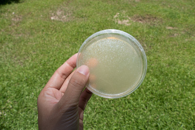 培养皿中琼脂培养基进行微生物板计数