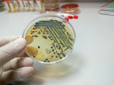 在微生物实验室背景下，技术员或科学家手持培养皿的手。细菌培养基。微生物学家。细菌。