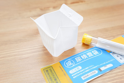 验尿