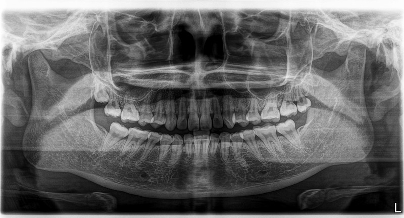 x光片头部和口腔