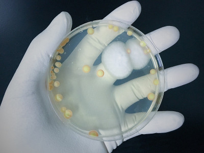 琼脂板上满是微生物和微生物