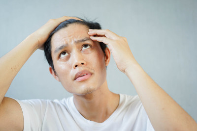 近距离看年轻人的正手，同时用手滑动头发来检查秃顶的人和健康的概念