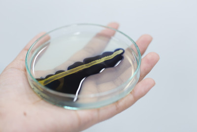 实验室用碘检测感染微生物。
