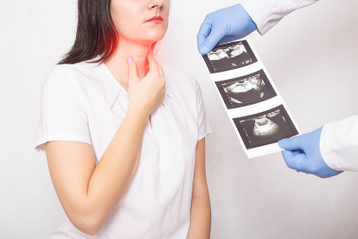 医生拿着一个女孩的甲状腺超声检查结果。甲状腺疾病，结节性甲状腺肿，癌症，内分泌学