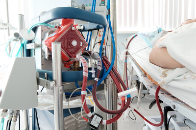 在重症监护室使用ecmo