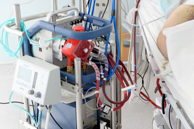 在重症监护室使用ecmo