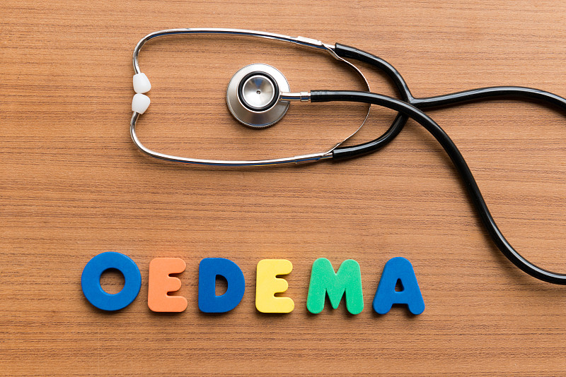 oedema