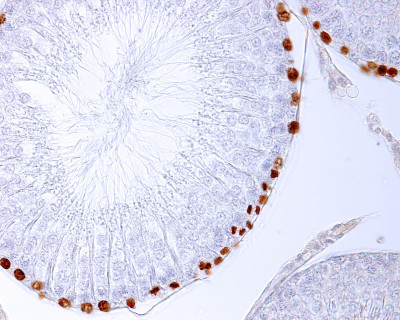 细精管。Spermatogonia