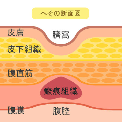 肚脐的结构