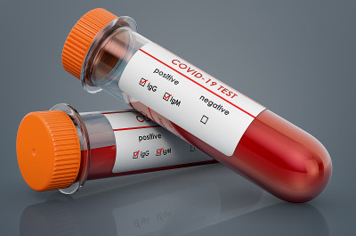 COVID-19，冠状病毒检测阳性血样试管，3D渲染