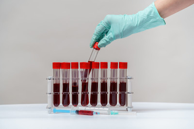 用于检测生物材料的血液样本管架