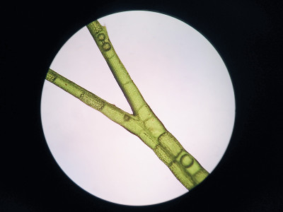 水生植物细胞的显微镜观察