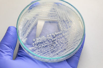 培养皿酵母菌，实验室微生物学教育。