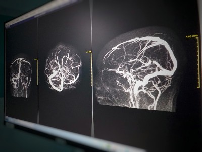 脑磁共振成像，医学成像技术，脑和血管的图像，这为医学诊断，疾病的阶段，应用于现代医院和诊所的放射学