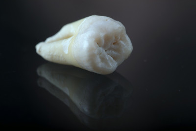 黑色背景上的人类牙齿
