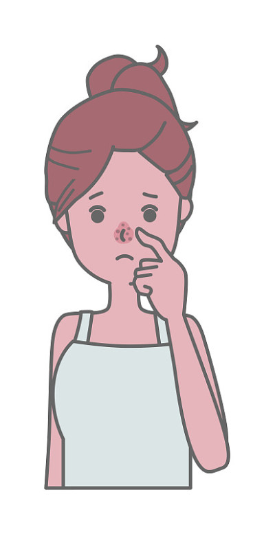 图示:一个遭受草莓鼻子毛孔污垢困扰的女人