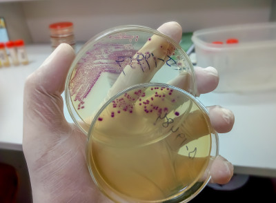 在微生物实验室背景下，技术员或科学家手持培养皿的手。细菌培养基。微生物学家。细菌。