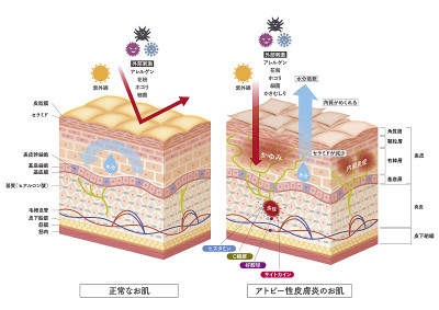 Cross section of the skin 3