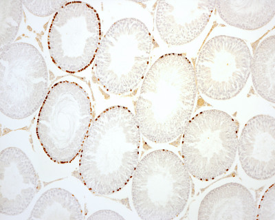 细精管。Spermatogonia