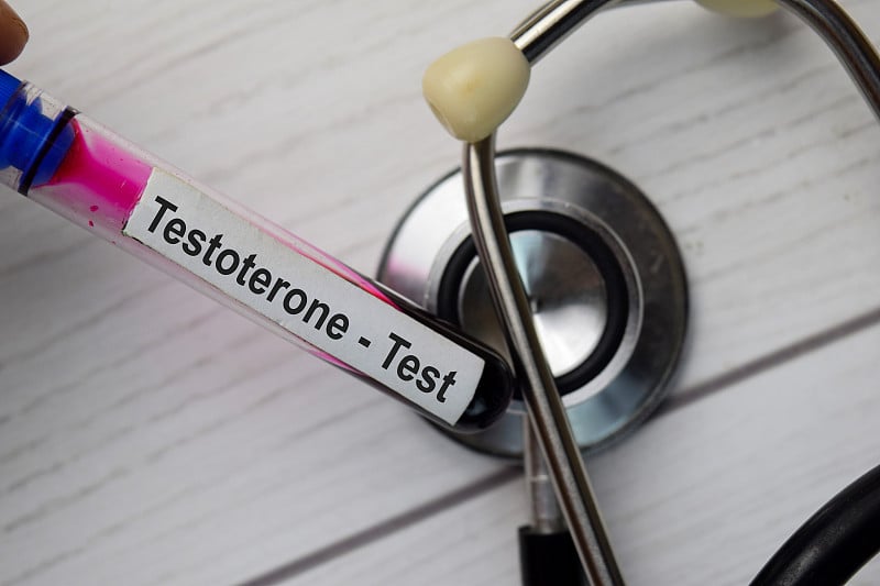 Testoterone - Test with blood sample. Top view iso