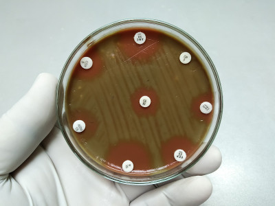 肺炎链球菌抗生素敏感性试验。