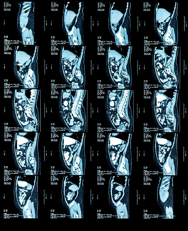 MRI扫描胸部和腹部图像。医疗诊断