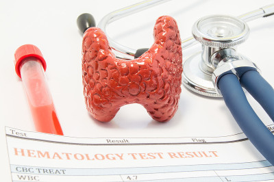 甲状腺解剖模型、听诊器和血检结果均在医生表上。通过甲状腺血液检测和治疗障碍来诊断或检测甲状腺疾病的概