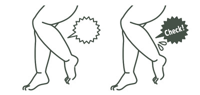 厚的女性legs-check