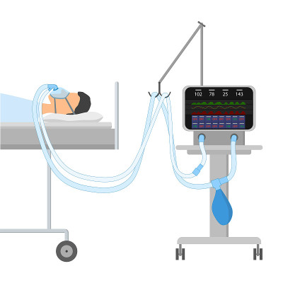 一个男人躺在床上伴有睡眠呼吸暂停和CPAP。在面罩上有两根氧气管与一个装置相连，用于人工通气。EPS