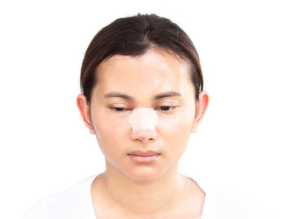 近脸的亚洲女性与鼻子整形美容的概念，白色的背景