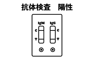 图示为抗体试验阳性结果