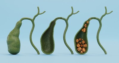 胆囊的现实3D渲染