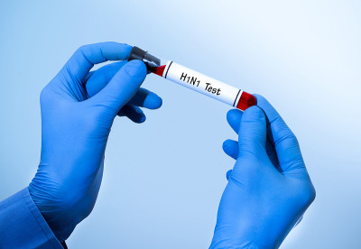 猪流感(H1N1)测试