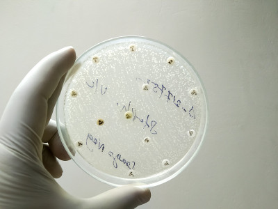 在医学微生物实验室进行抗菌药物敏感性试验。显示真菌生长，白色念珠菌。