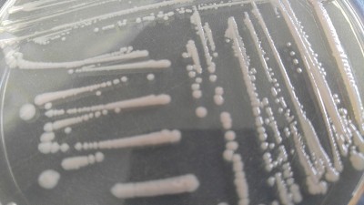 培养皿，琼脂上有各种菌落