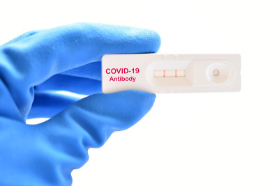 COVID-19阳性检测结果