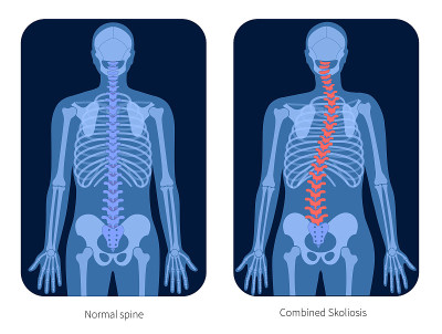 Pain4_Skeleton