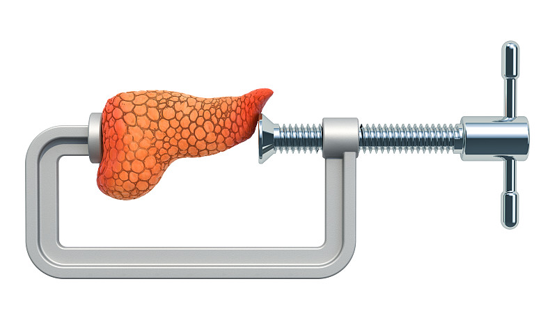 胰腺疼痛。与人体胰腺Vise, 3D渲染孤立在白色背景