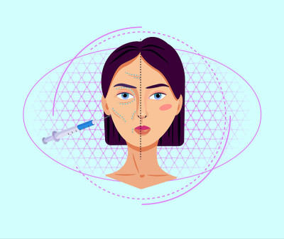 抗衰老胶原蛋白注射插图。光疗程序消除皱纹。